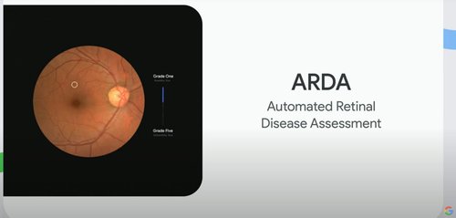 스마트폰으로 망막질환 검사가 가능한 헬스케어 앱 ARDA