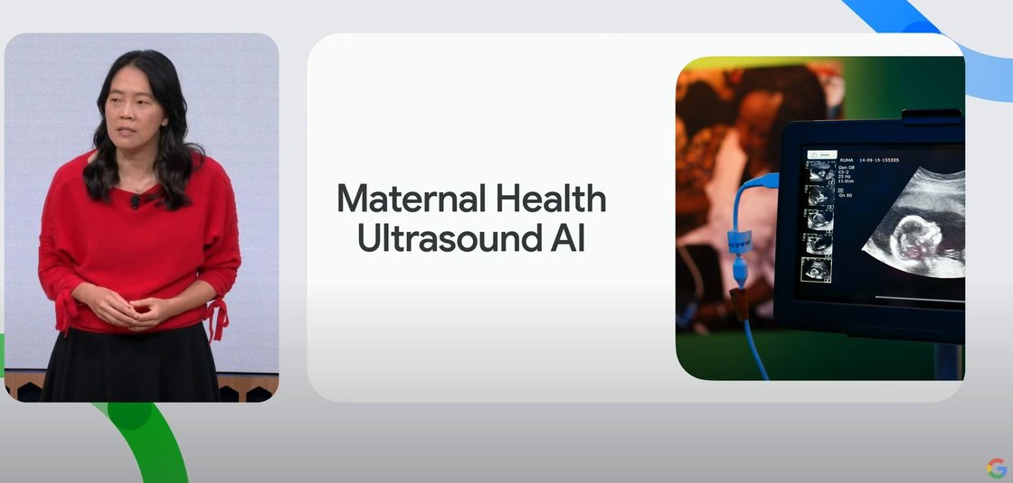 산모 건강을 위한 구글 초음파 AI